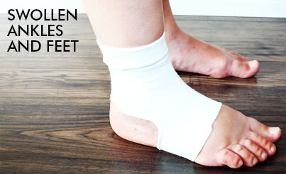 What causes Swollen feet?